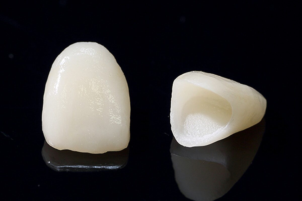 審美治療の主なメニュー